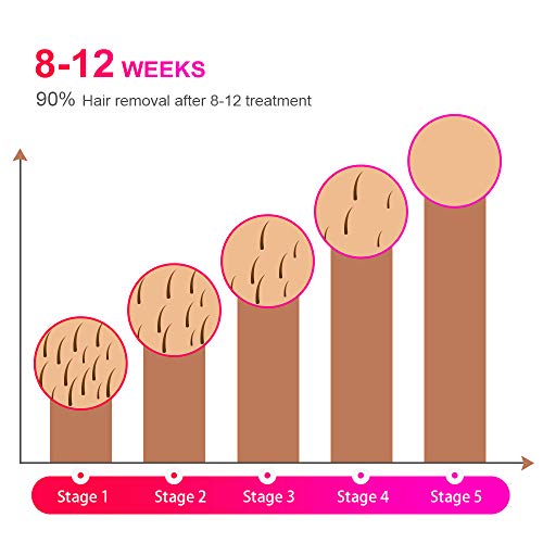 IPL Depiladora de Luz Pulsada, Permanente Láser Depilación sistema 2 Modos, 999,999 Flashes Láser de Depilación Permanente para Cuerpo Láser Profesional sin Dolor para el Hogar, Mujeres y Hombres