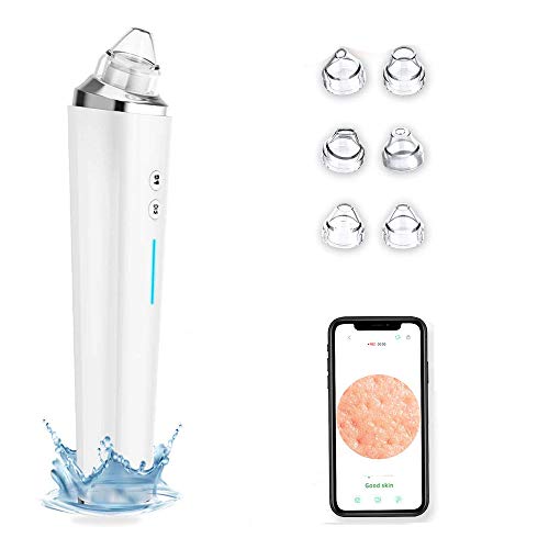 Limpiador De Poros, WiFi Succionador De Puntos Negros Limpiador Facial Blackhead, Iimpiador De Poros Facial Kit Herramienta De Succión De Espinillas Recargable USB,Blanco