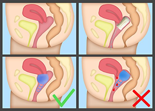 Merula Cup apple (verde) - Tamaño único copa menstrual de silicona de grado médico