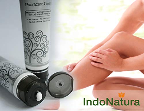 Naturalissimi Psoracare Cream Psoriasis, prurito crema psoriasis con aceites ayurvédicos