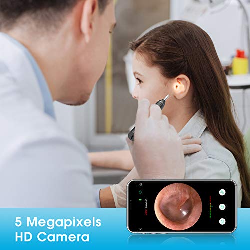 Otoscopio VITCOCO Endoscopio Camara Endoscopica 5MP Otoscopio WIFI 3mm con 6 LED Ajustables para iOS Android Tabletas