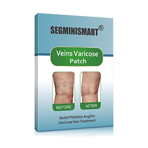 Venas Varicosas,Varicose Vein Treatment,Alivio rápido de Varices,Mejora la circulación sanguínea en las piernas,alivio de flebitis, angiitis, inflamación de vasos sanguíneos