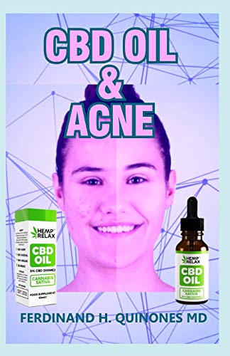 CBD OIL AND ACNE: All You Need To Know  About The CBD OIL (The Perfect Cure for Acne)