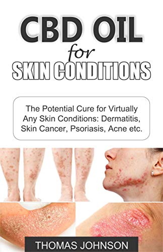 CBD OIL FOR SKIN CONDITIONS: The Potential Cure for Virtually Any Skin Conditions: Dermatitis, Skin Cancer, Psoriasis, Acne etc. (English Edition)