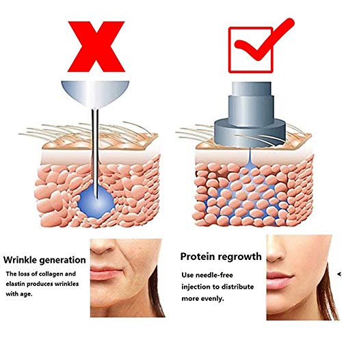 DXMBHL Hialurónico Inyección Bolígrafo Equipo Jeringuilla Nebulizador Sin Aguja Inyección para Salones de Belleza caseros Eliminación de Arrugas Reposición Hidratante,A