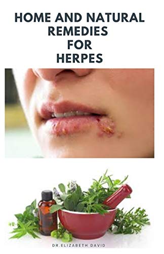 HOME AND NATURAL REMEDIES FOR HERPES: The Best Herbal And Natural Remedies To Get Rid Of All Form Of Herpes Virus