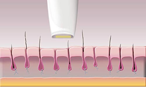 SILK'N Jewel LUXX Depilación Permanente con luz pulsada, Todo Tipo De Piel, 200.000 Impulsos De Luz, Tecnología HPL