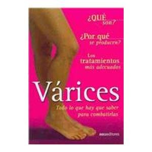 Varices/ Varicose Veins: Todo Lo Que Hay Que Saber Para Combatirlas