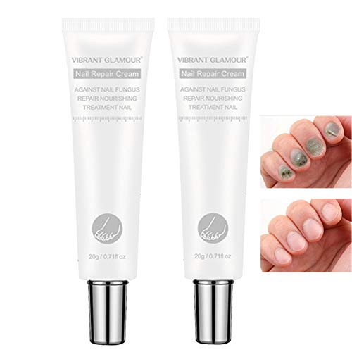 AMYGG Tratamiento de Uñas Crema Reparación de Uñas Renovar Dañado Roto Agrietado Uñas Descoloridas (2 PCS)