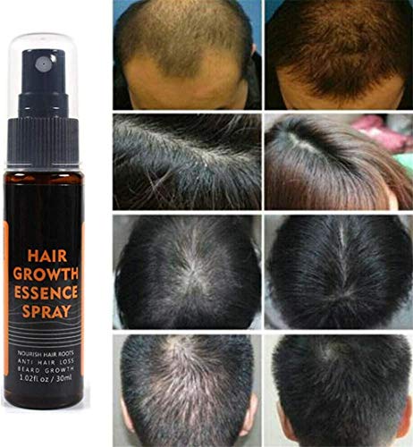 Hair Regrowth Essence Intensive Spray, Natural Ingredients Hair Regrowth Anti-Loss Hair Fluid Used for Anti Hair Loss, Wake up The Scalp and reproduce Thick Hair, for Men for Women