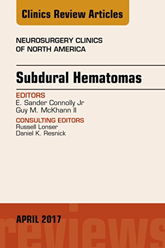 Subdural Hematomas, An Issue of Neurosurgery Clinics of North America, E-Book (The Clinics: Surgery) (English Edition)