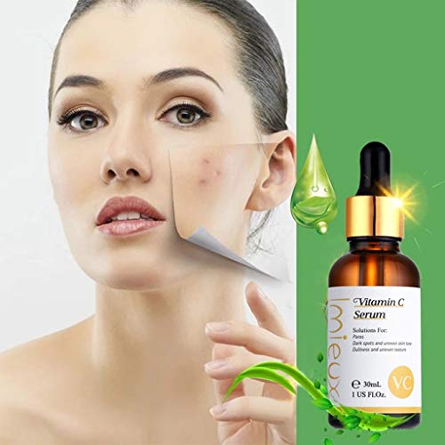 WARMWORD Serum Facial Vitamina C y Acido Hialuronico | Anti Edad, Anti Arrugas, Anti Manchas | Suero Hidratante, No graso, Tonifica y Reafirma | Natural para una Piel Sana y Joven