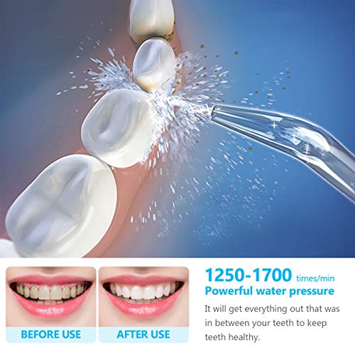 YOUNGDO Irrigador Bucal 600 ML, Irrigador Dental Professional con 10 Ajustes de Presión del Agua y 8 Boquillas Multifuncionales, para Cuidado y Limpieza Dental de Toda La Familia Aprobado por la FDA