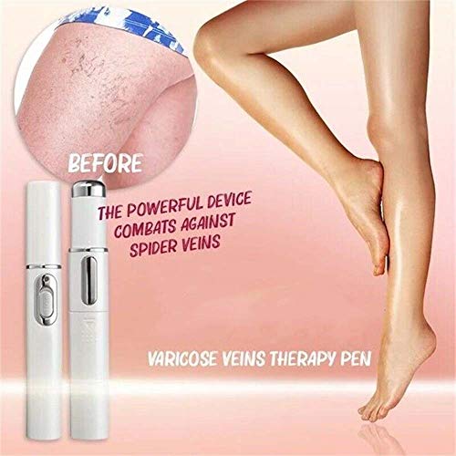 New Blue Light Therapy Varicose Veins Pen - Soft Scar Acne Wrinkle Removal, Improve Skin Elasticity