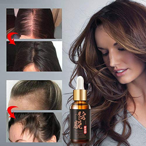 Tratamiento de Crecimiento rápido del Cabello Aceite Esencial para el Cabello - Pack: fsjyfy019