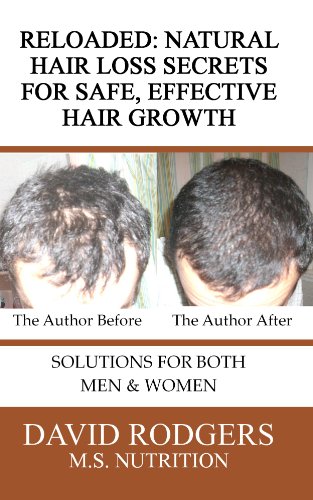 Reloaded: Natural Hair Loss Secrets for Safe, Effective Hair Growth (English Edition)