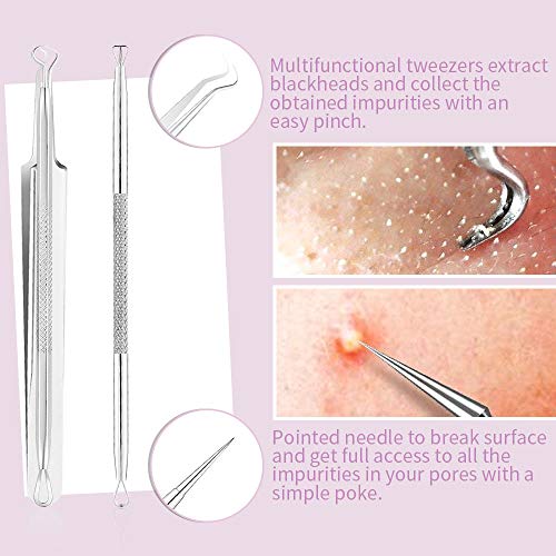 Extractor de Puntos Negros Kit UBITREE 7 Pcs Blackhead Remover Aguja de Acné Herramientas (con caja), Quita Espinillas Negros Comedones Extractor