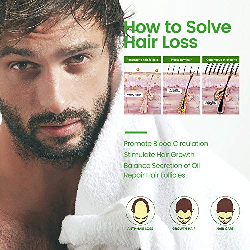 Serum de Crecimiento del Cabello con Esencia de Jengibre para Anticaida de Cabello y Crece Pelo, Nutrir los Folículo Piloso de hombres y mujeres para el Crece Rápido y Completo del Cabello