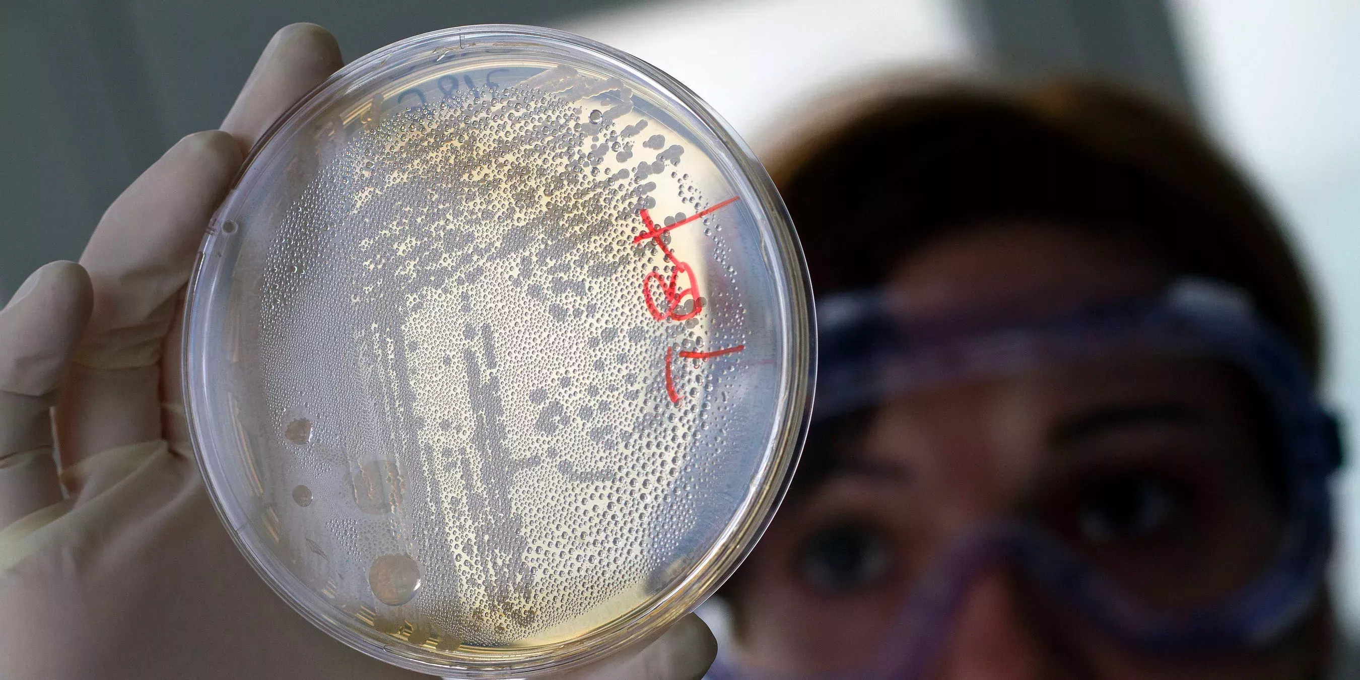 Los CDC relacionan el misterioso brote de E. coli con los sándwiches de Wendy's con lechuga romana