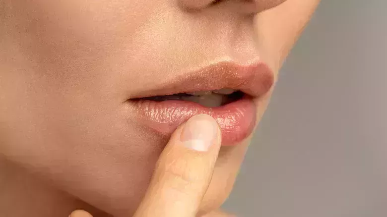 Cómo tratar los incómodos labios quemados por el sol