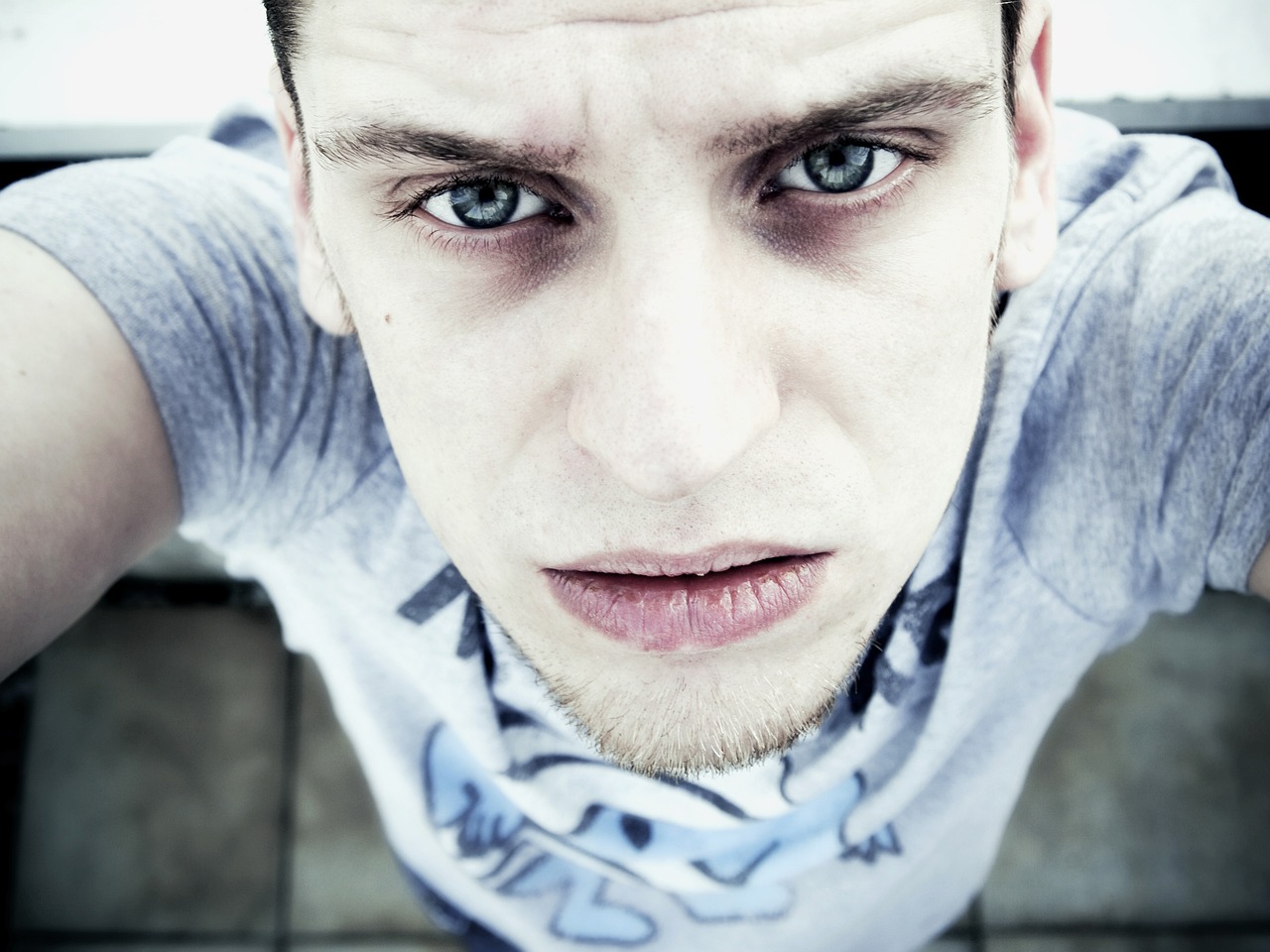 ¿Qué enfermedad refleja las ojeras? ¿Qué enfermedad refleja las ojeras?