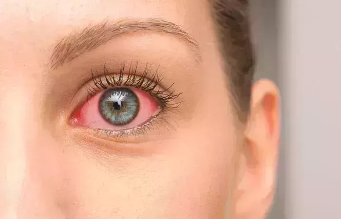 Aceite de ricino para los ojos: tipos, beneficios y consejos de aplicación