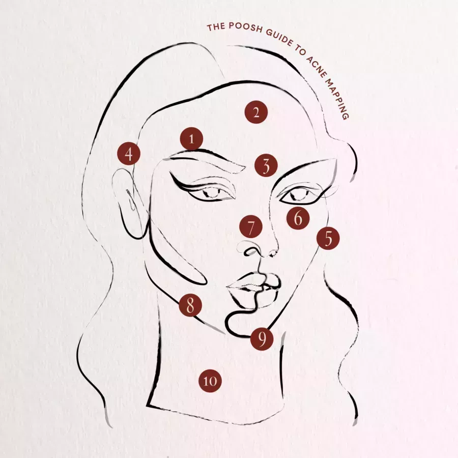 acne mapping graphic