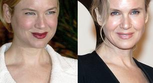 Renée Zellweger con nueva cara tras retocarse 