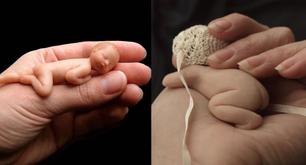 Los bebés de esta mujer son tan pequeños... ¡que caben en la palma de la mano!