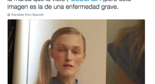 Julia Otero denuncia en Twitter la foto de una modelo extremadamente delgada