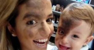 Se maquilla la marca que tiene su hijo en la cara y se hace viral.